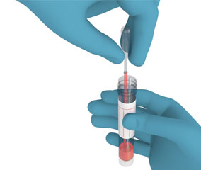 Genetische Probe